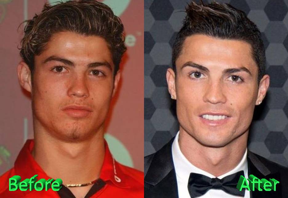 Image result for cristiano ronaldo plastic surgery news