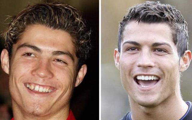 Cristiano Ronaldo Before and After