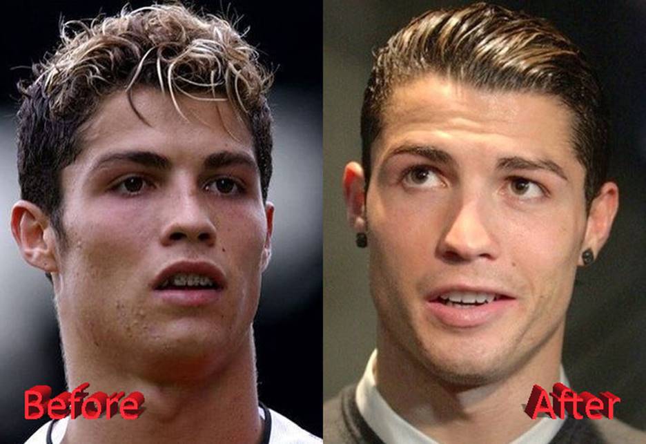 Image result for cristiano ronaldo plastic surgery news